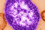 Microscopic image of a single measles virus particle stained in purple, showing its spherical shape and textured surface.