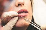 How cosmetic procedures interfere with self-accept