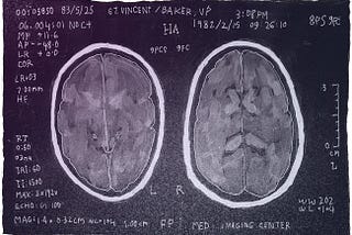 brain scans.